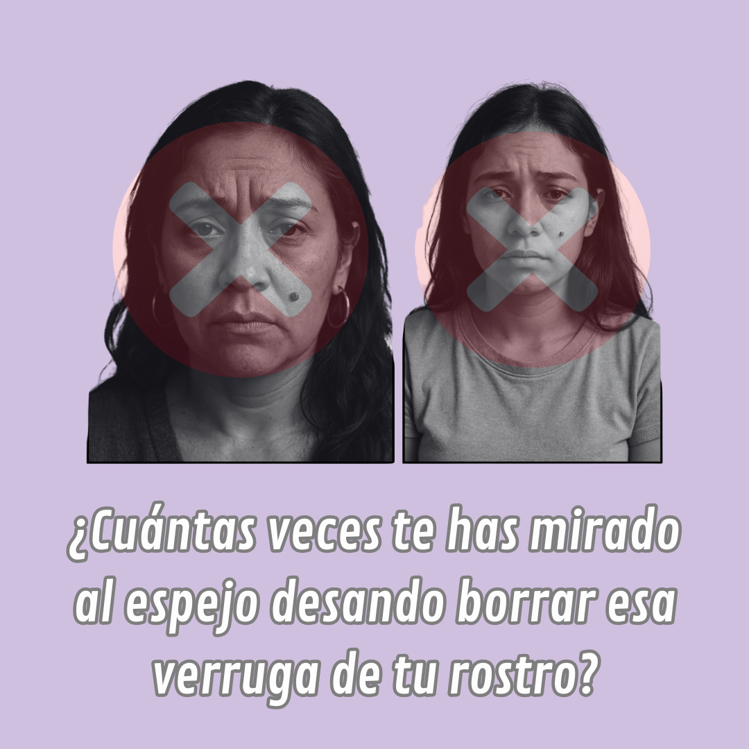 Luminiix Eliminador De Verrugas